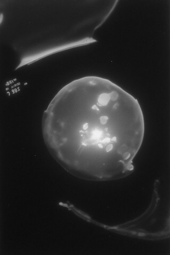 fetal heartbeat development timeline